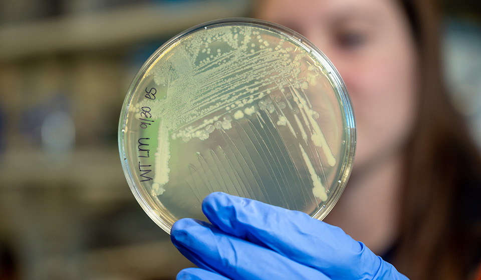 Petri dish with bacteria swap