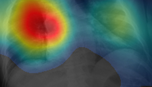 Colorful image of lung scan run through the AI COVID-19 detecting software