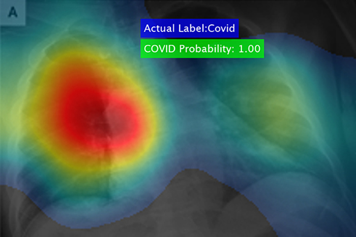 COVID-19 detection process imagery