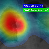 COVID-19 detection process